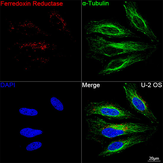 FDXR Antibody in Immunocytochemistry (ICC/IF)