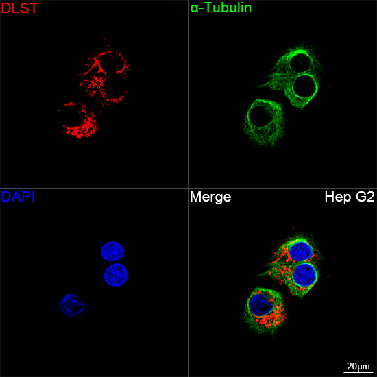 DLST Antibody in Immunocytochemistry (ICC/IF)
