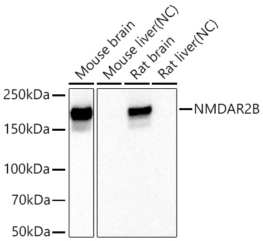 NMDAR2B Antibody in Western Blot (WB)