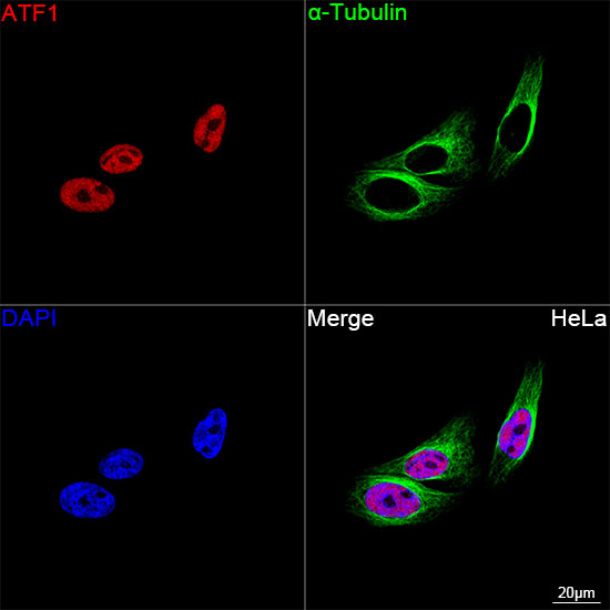 ATF1 Antibody in Immunocytochemistry (ICC/IF)
