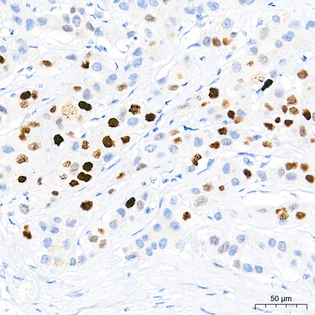 UHRF1 Antibody in Immunohistochemistry (Paraffin) (IHC (P))