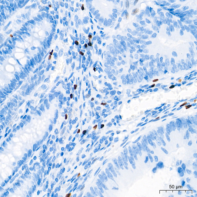 FOXP3 Antibody in Immunohistochemistry (Paraffin) (IHC (P))