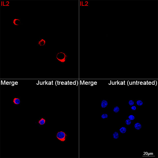 IL-2 Antibody in Immunocytochemistry (ICC/IF)
