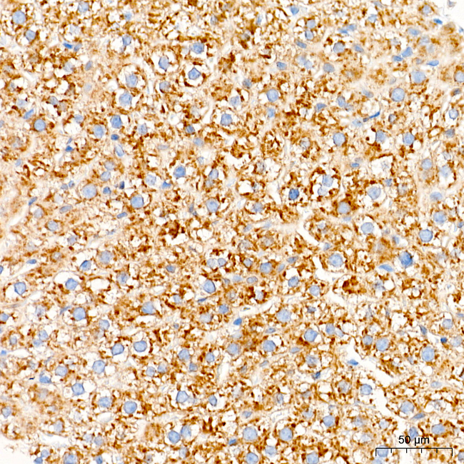 ABHD6 Antibody in Immunohistochemistry (Paraffin) (IHC (P))