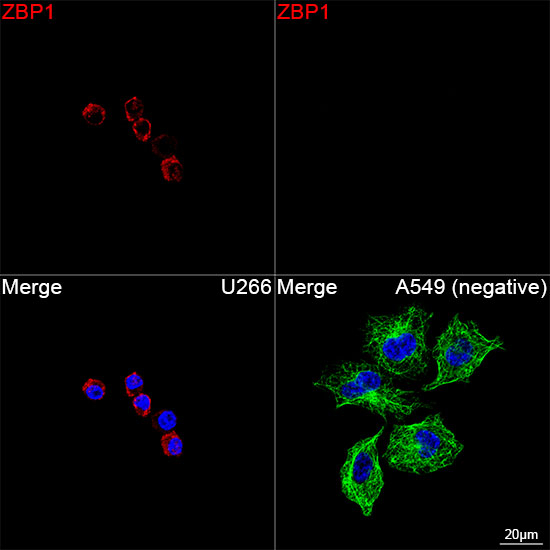 ZBP1 Antibody in Immunocytochemistry (ICC/IF)