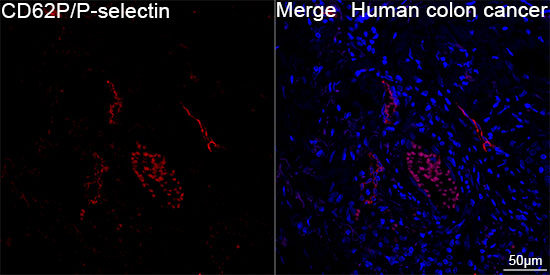 P-Selectin Antibody in Immunohistochemistry (Paraffin) (IHC (P))