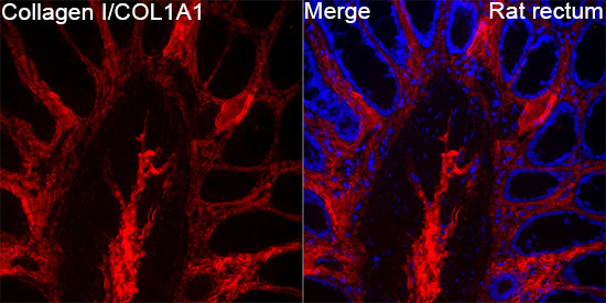 COL1A1 Antibody in Immunohistochemistry (Paraffin) (IHC (P))