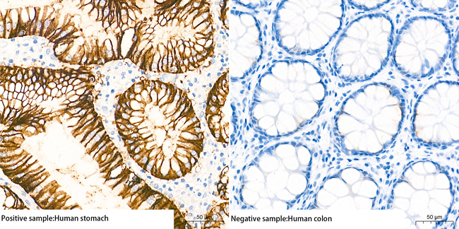 Claudin 18.2 Antibody in Immunohistochemistry (Paraffin) (IHC (P))