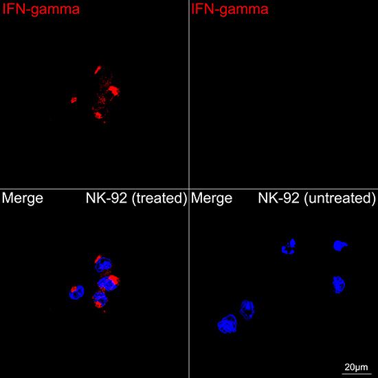 IFN gamma Antibody in Immunocytochemistry (ICC/IF)