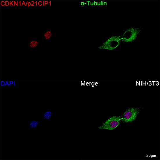 p21 Antibody in Immunocytochemistry (ICC/IF)
