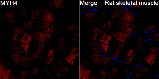 Myosin 4 Antibody in Immunohistochemistry (Paraffin) (IHC (P))