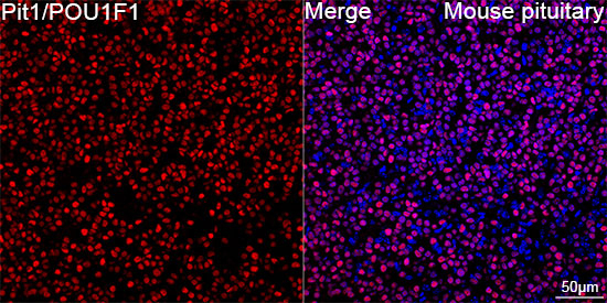 PIT1 Antibody in Immunohistochemistry (Paraffin) (IHC (P))