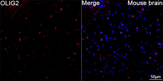 OLIG2 Antibody in Immunohistochemistry (Paraffin) (IHC (P))