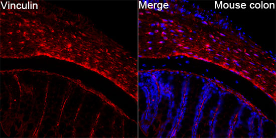 Vinculin Antibody in Immunohistochemistry (Paraffin) (IHC (P))