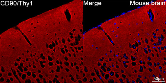 CD90 Antibody in Immunohistochemistry (Paraffin) (IHC (P))