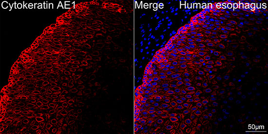 Cytokeratin 10/14/15/16/19 Antibody in Immunohistochemistry (Paraffin) (IHC (P))