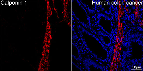 Calponin 1 Antibody in Immunohistochemistry (Paraffin) (IHC (P))