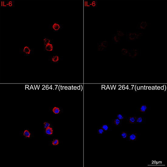 IL-6 Antibody in Immunocytochemistry (ICC/IF)