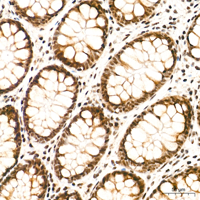 KIAA1429 Antibody in Immunohistochemistry (Paraffin) (IHC (P))
