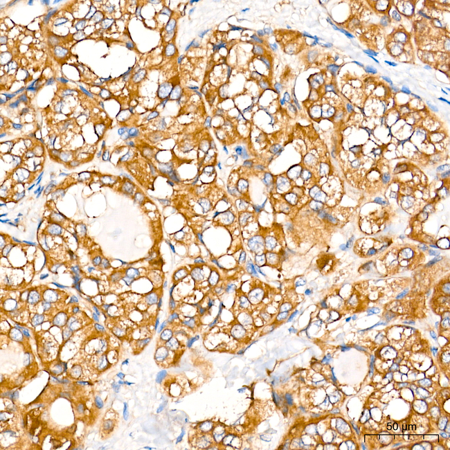 IDE Antibody in Immunohistochemistry (Paraffin) (IHC (P))