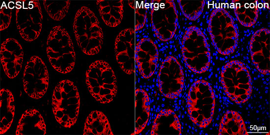 ACSL5 Antibody in Immunohistochemistry (Paraffin) (IHC (P))