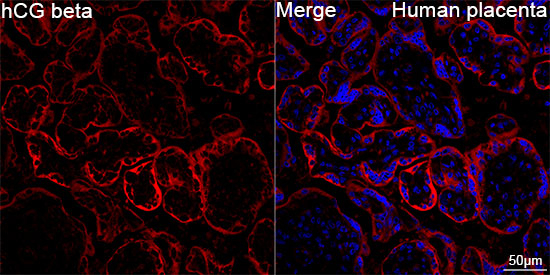 hCG beta Antibody in Immunohistochemistry (Paraffin) (IHC (P))