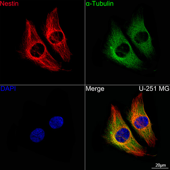 Nestin Antibody in Immunocytochemistry (ICC/IF)