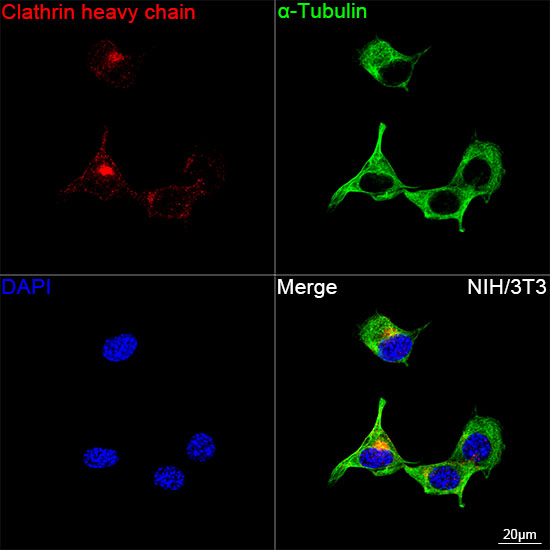 Clathrin Heavy Chain Antibody in Immunocytochemistry (ICC/IF)