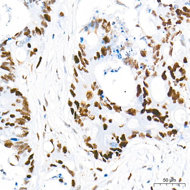Rb Antibody in Immunohistochemistry (Paraffin) (IHC (P))