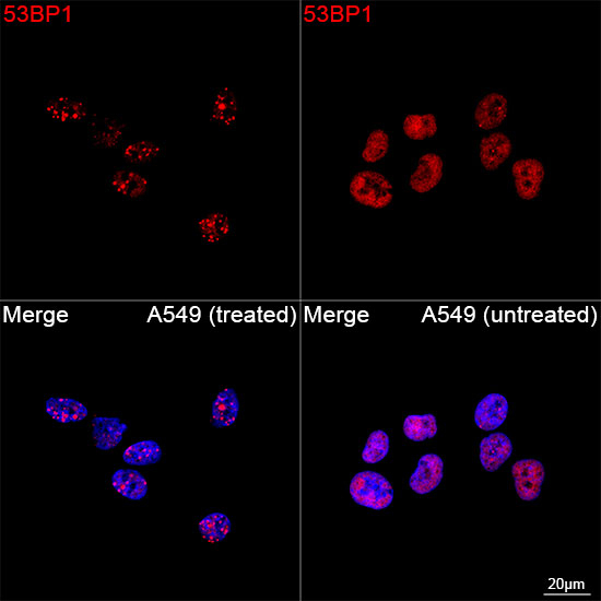 53BP1 Antibody in Immunocytochemistry (ICC/IF)
