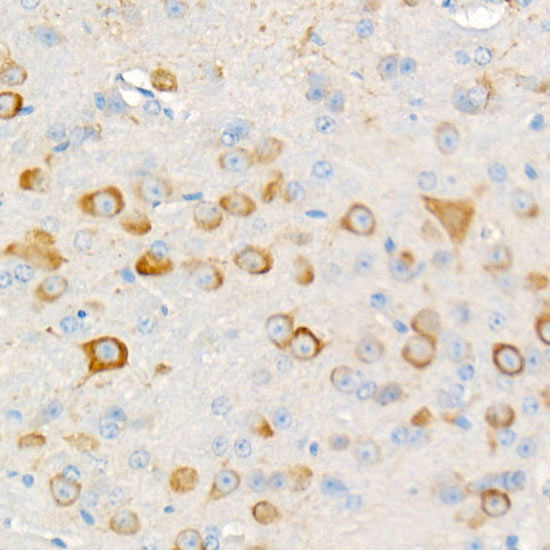 Phospho-S6 (Ser235, Ser236) Antibody in Immunohistochemistry (Paraffin) (IHC (P))