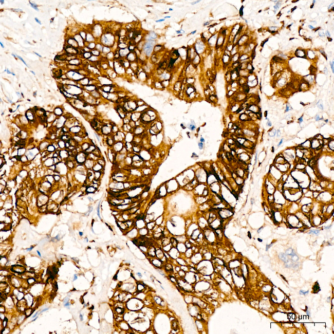 Phospho-S6 Ribosomal (Ser240, Ser244) Antibody in Immunohistochemistry (Paraffin) (IHC (P))