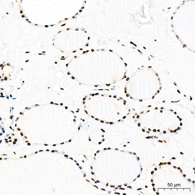 Phospho-Rb (Ser795) Antibody in Immunohistochemistry (Paraffin) (IHC (P))