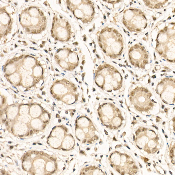 Phospho-NFkB p100 (Ser866, Ser870) Antibody in Immunohistochemistry (Paraffin) (IHC (P))