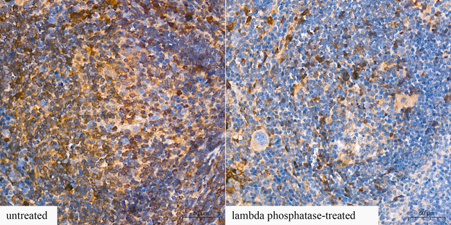 Phospho-PKC Pan (Ser660) Antibody in Immunohistochemistry (Paraffin) (IHC (P))