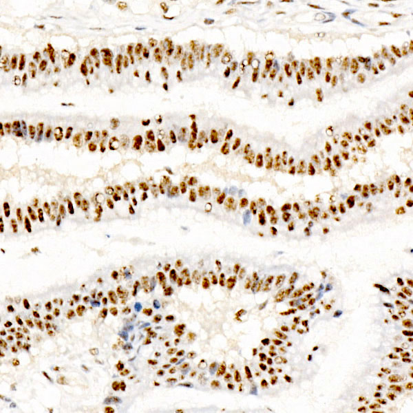 Phospho-CREB (Ser133) Antibody in Immunohistochemistry (Paraffin) (IHC (P))