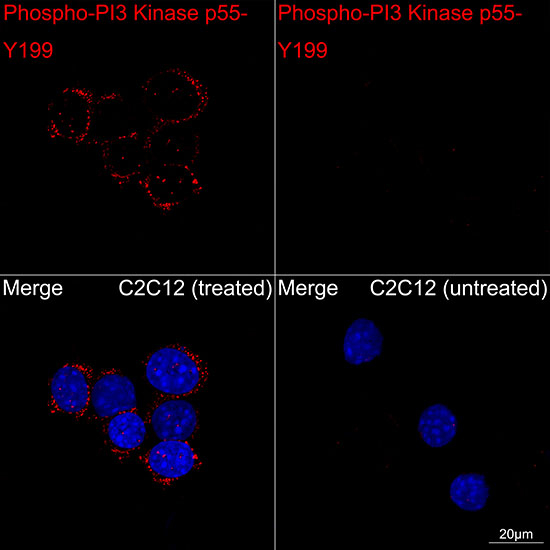 Phospho-PI3K p55 gamma (Tyr199) Antibody in Immunocytochemistry (ICC/IF)