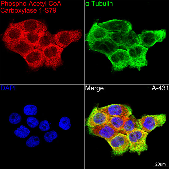 Phospho-Acetyl-CoA Carboxylase (Ser79) Antibody in Immunocytochemistry (ICC/IF)