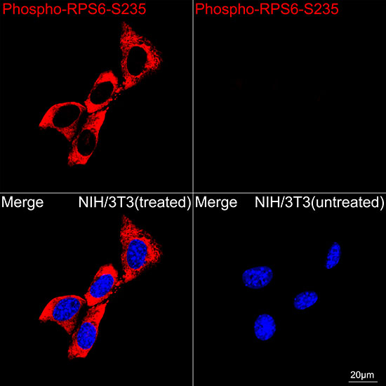Phospho-S6 (Ser235) Antibody in Immunocytochemistry (ICC/IF)
