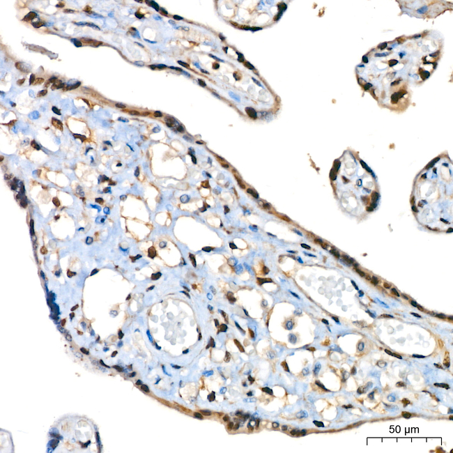 Phospho-ATP Citrate Lyase (Ser455) Antibody in Immunohistochemistry (Paraffin) (IHC (P))