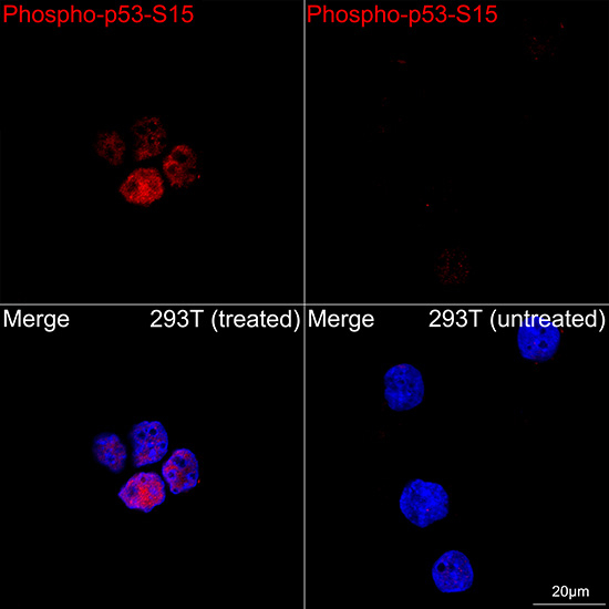 Phospho-p53 (Ser15) Antibody in Immunocytochemistry (ICC/IF)