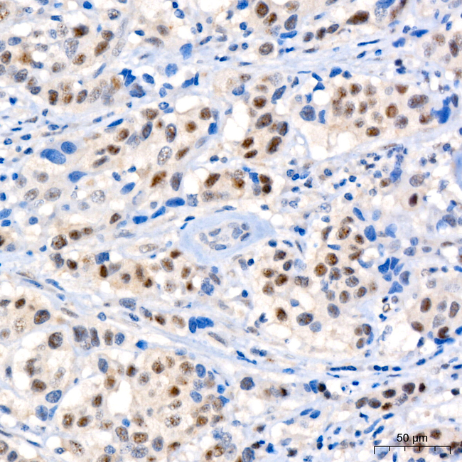 Phospho-IRS1 (Ser612, Ser636) Antibody in Immunohistochemistry (Paraffin) (IHC (P))