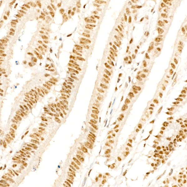 Phospho-p38 MAPK (Thr180) Antibody in Immunohistochemistry (Paraffin) (IHC (P))