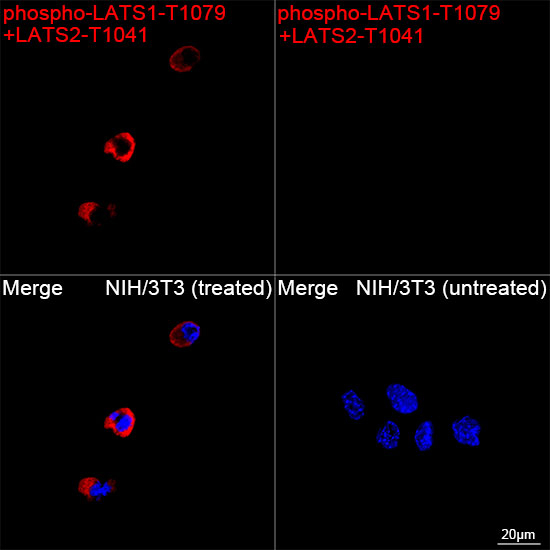 Phospho-LATS1/LATS2 (Thr1079, Thr1041) Antibody in Immunocytochemistry (ICC/IF)