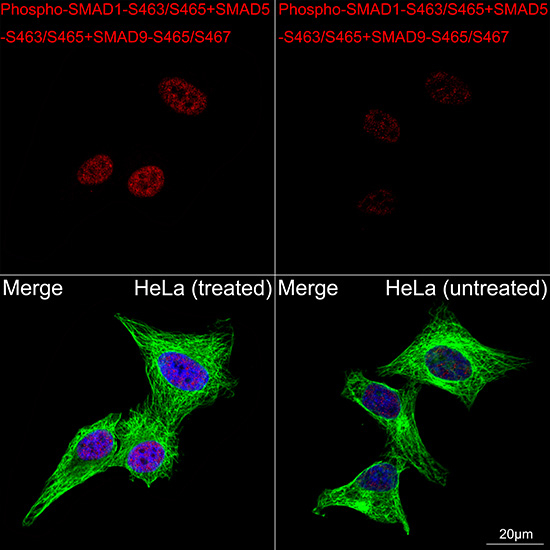 Phospho-SMAD1 (Ser463, Ser465, Ser467) Antibody in Immunocytochemistry (ICC/IF)