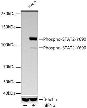 Phospho-STAT2 (Tyr690) Antibody in Western Blot (WB)