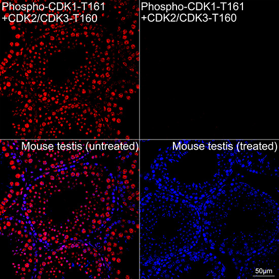 Phospho-CDK1/CDK2/CDK3 (Thr161, Thr160) Antibody in Immunohistochemistry (Paraffin) (IHC (P))