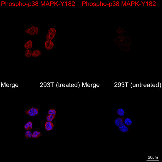 Phospho-p38 MAPK (Tyr182) Antibody in Immunocytochemistry (ICC/IF)