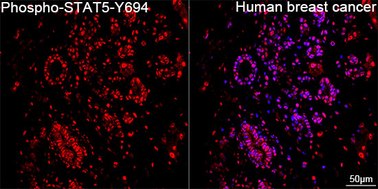 Phospho-STAT5 alpha/beta (Tyr694) Antibody in Immunohistochemistry (Paraffin) (IHC (P))