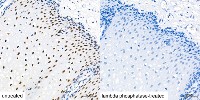 Phospho-C/EBP beta (Thr235) Antibody in Immunohistochemistry (Paraffin) (IHC (P))